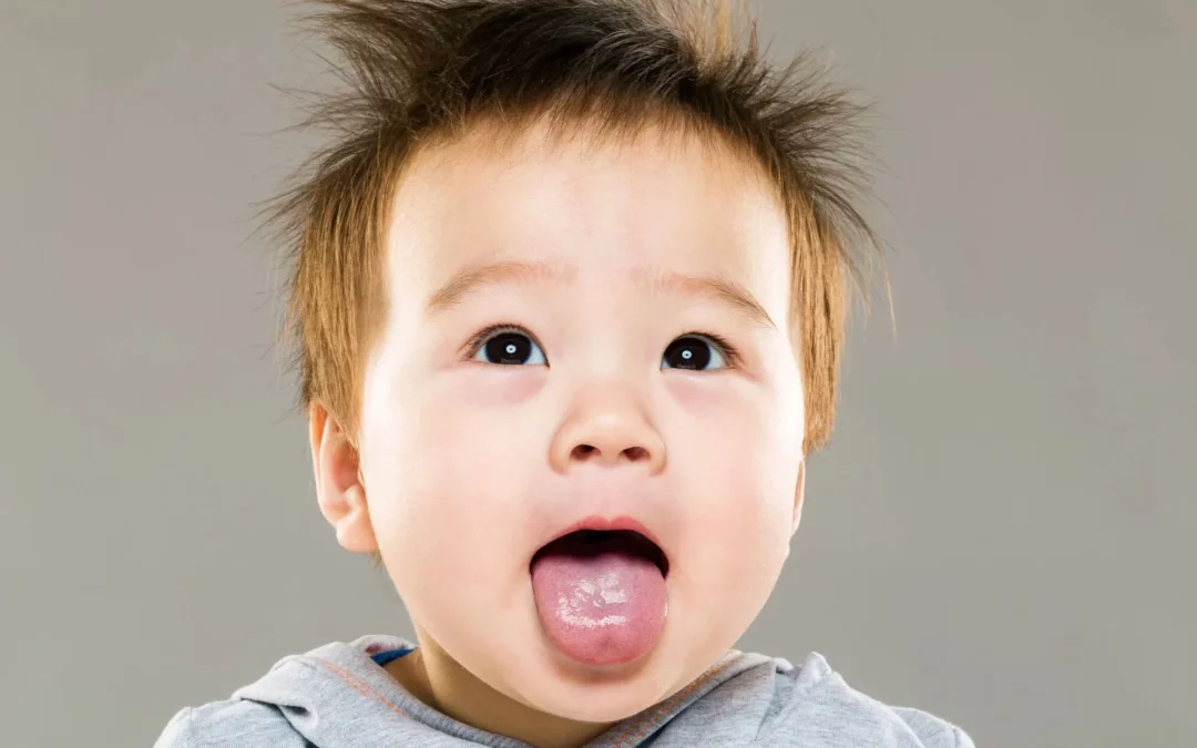 FAQs about Tongue-Tie Laser Surgery: What Every Parent Should Know